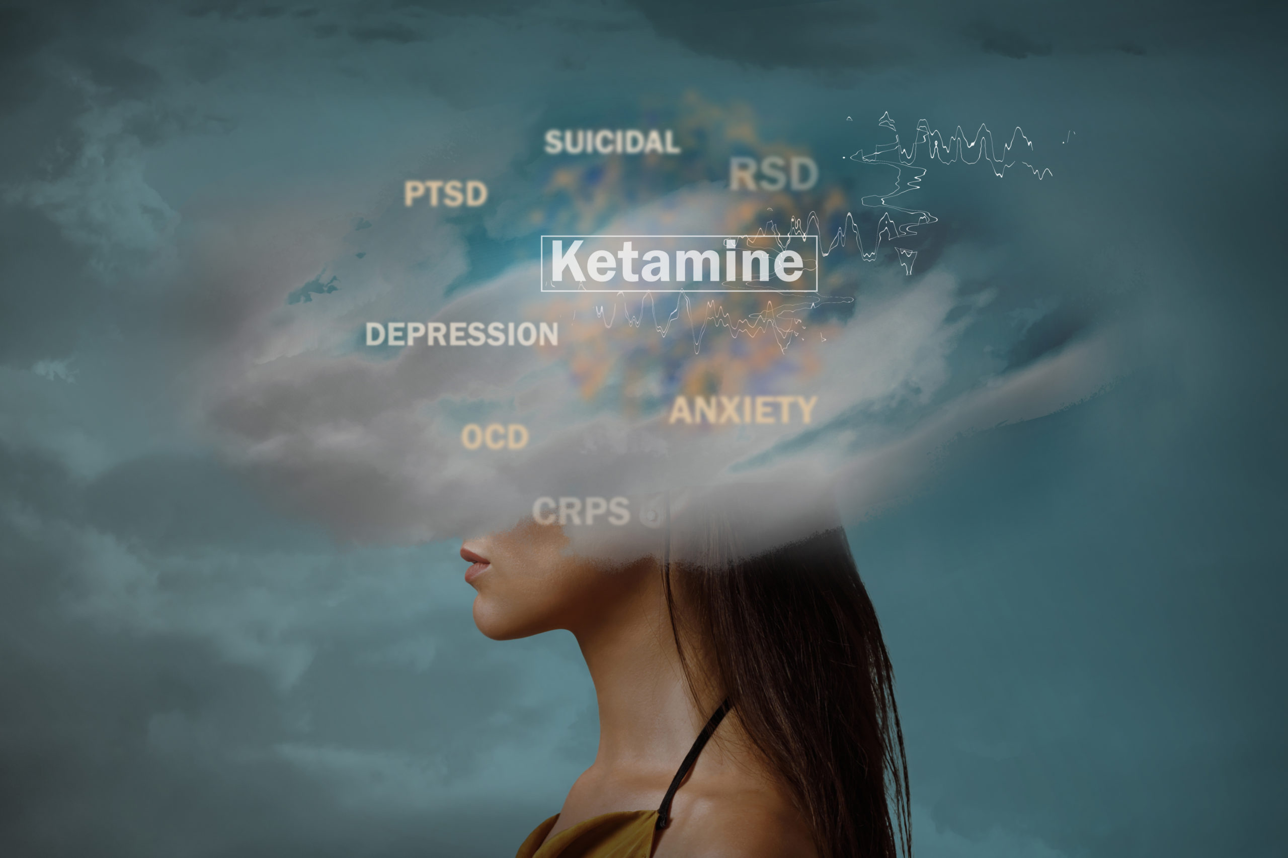 How Does Ketamine Infusion Therapy Treat Depression?